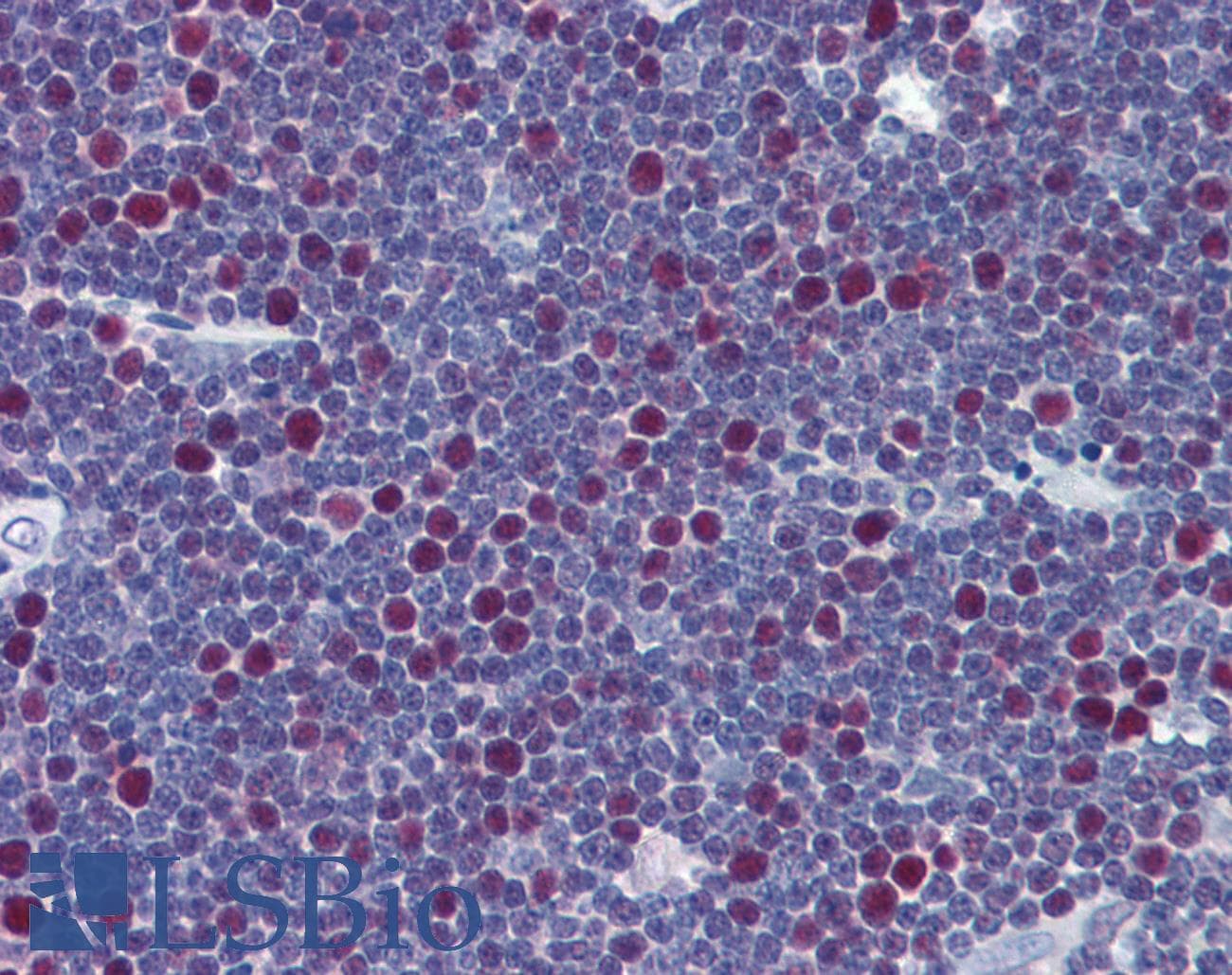 IHC-plus™ LIG1 / DNA Ligase 1 Antibody (clone 10G12)