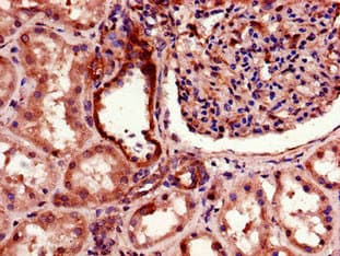Polyclonal Rabbit anti-Human TGFBRAP1 / TRAP-1 Antibody