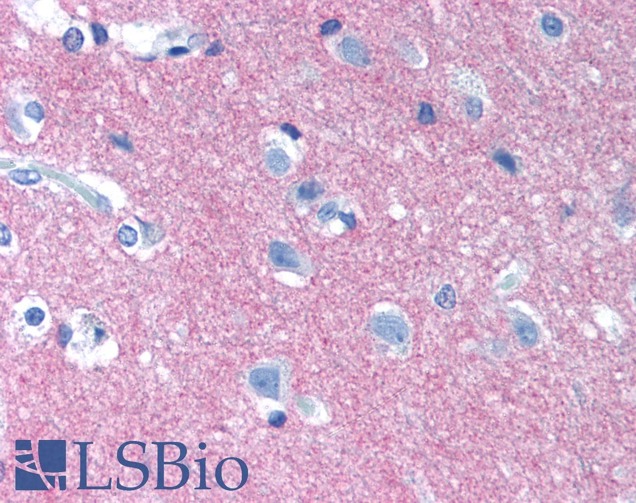 IHC-plus™ Monoclonal Mouse anti-Human NCAM / CD56 Antibody (clone MEM-188, IHC, WB)