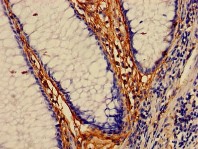 Polyclonal Rabbit anti-Human MAP3K7 / TAK1 Antibody