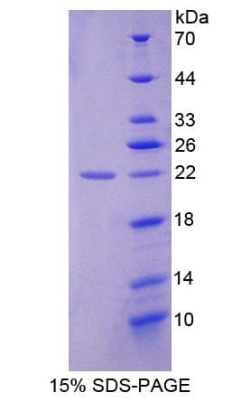 Human IGF2R / CD222 Protein (Recombinant His-S)