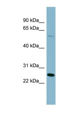 QRSL1 / GatA Antibody (aa143-192)