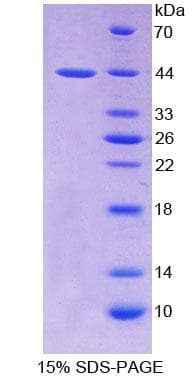 Rat PTHR2 / PTH2R Protein (Recombinant His-GST)