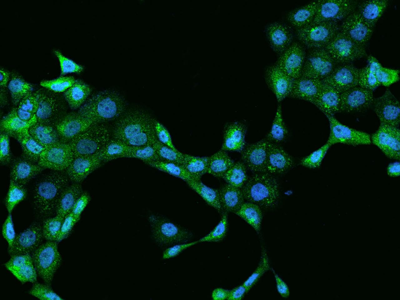 PLIN3 / M6PRBP1 / TIP47 Antibody