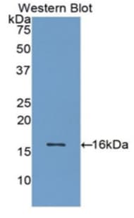 ADM / Adrenomedullin Antibody (aa22-147, Biotin)