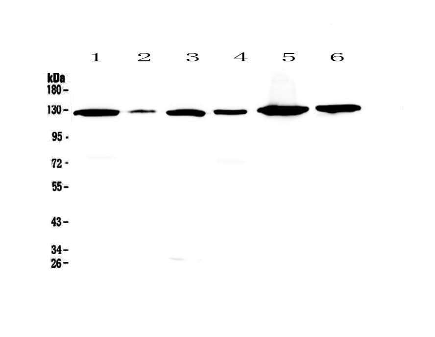 FLT1 / VEGFR1 Antibody
