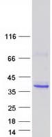 Human FCN2 / Ficolin-2 Protein (Recombinant Myc-DDK (Flag))