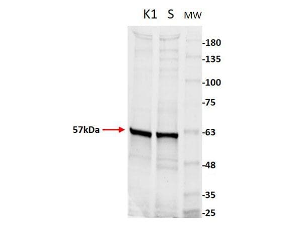 Pyruvate Kinase Antibody (Lyophilized)