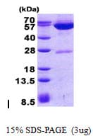 Human GPT2 / ALT2 Protein (Recombinant His)