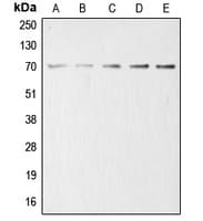 ACHE / Acetylcholinesterase Antibody (Internal)