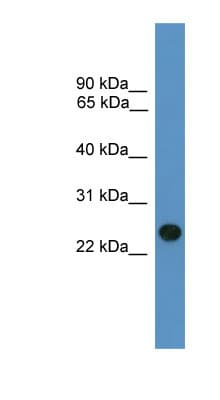 Polyclonal Rabbit anti-Human BNIP1 Antibody (C-Terminus, WB)