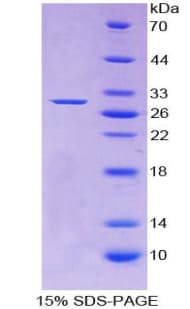 Human ADCY1 / Adenylate Cyclase 1 Protein (Recombinant His-T7)
