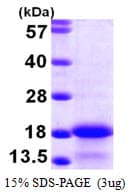 Human MYL6 Protein (Recombinant 6His, N-terminus)