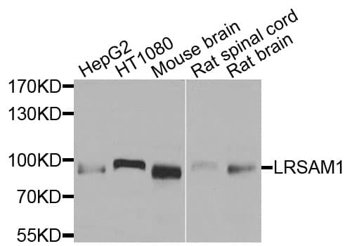 Polyclonal Rabbit anti-Human LRSAM1 Antibody (WB)