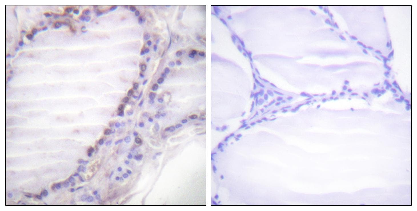 FOS / c-FOS Antibody (phospho-Ser362)