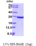 Mouse SOD2 / Mn SOD Protein (Recombinant His)