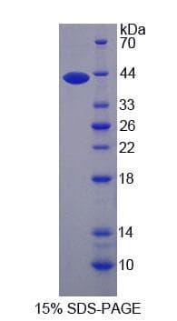 Human NARS Protein (Recombinant His-T7, N-terminus)