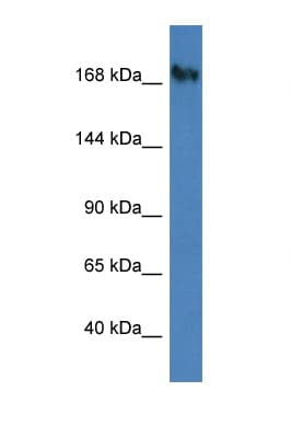 NUP153 Antibody (aa1127-1176)