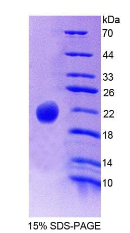 Mouse PLCB3 Protein (Recombinant His-T7)