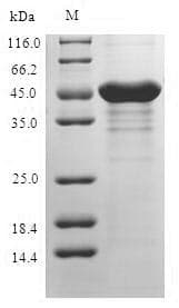 Human S100A3 / S100E Protein (Recombinant GST, N-terminus)