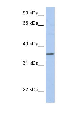 Polyclonal Rabbit anti-Human PRR18 Antibody (aa35-84, WB)