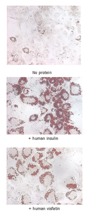 Human NAMPT / Visfatin Protein (Recombinant His)