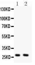 OLIG1 Antibody (aa94-109)