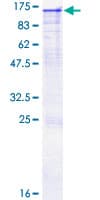 Human OSBPL8 Protein (Recombinant GST)