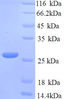 Klebsiella pneumoniae blaNDM-1 / Metallo-beta-Lactam Protein (Recombinant His)