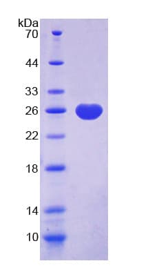 Rat UCHL1 / PGP9.5 Protein (Recombinant His)