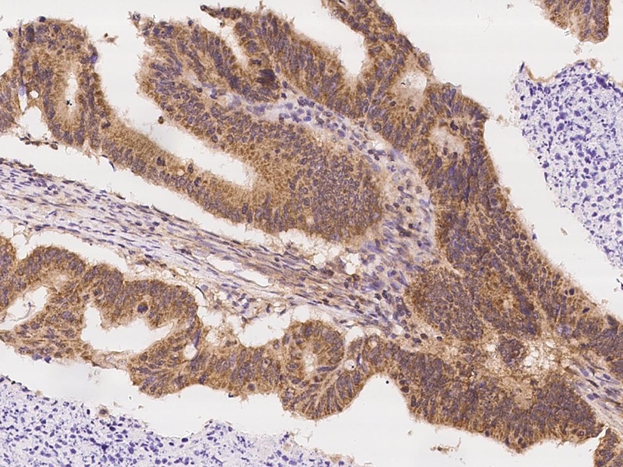 IL12RB1 / CD212 Antibody
