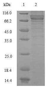 Human NNMT Protein (Recombinant GST, N-terminus)