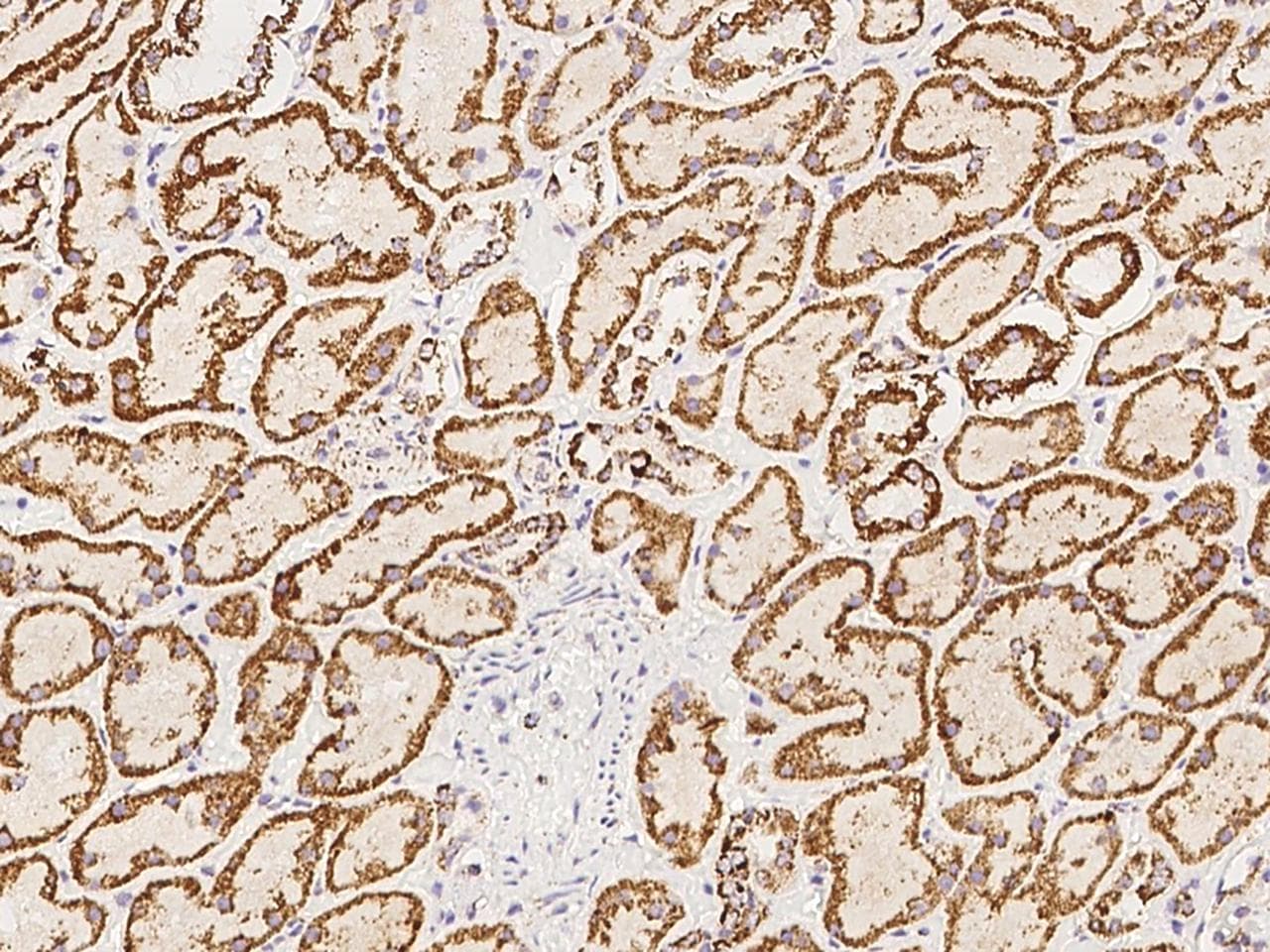 HRASLS2 Antibody
