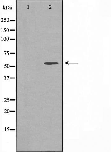 Polyclonal Rabbit anti-Human CCT8 Antibody (IF, WB)