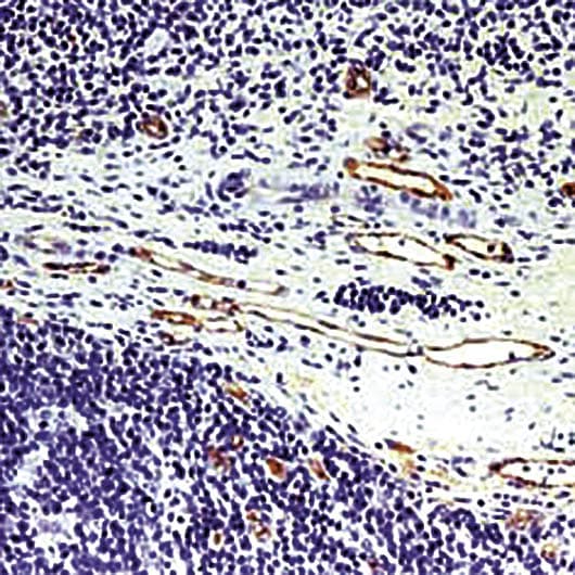 VWF / Von Willebrand Factor Antibody (clone F8/86)
