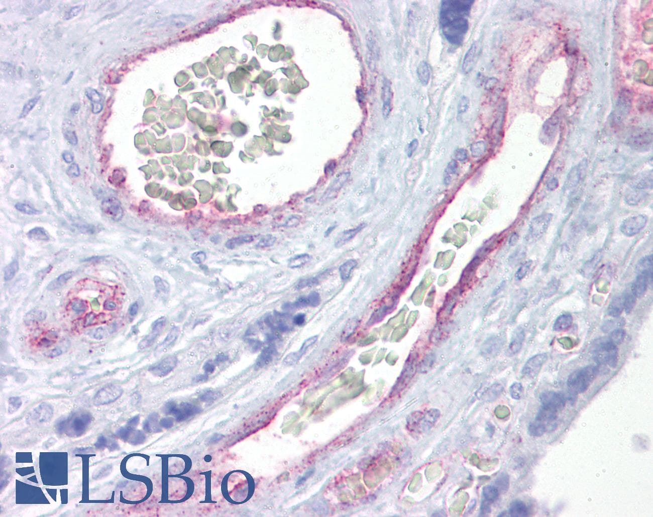 Polyclonal Rabbit anti-Human BMAL2 / ARNTL2 Antibody (aa35-84, IHC, WB)