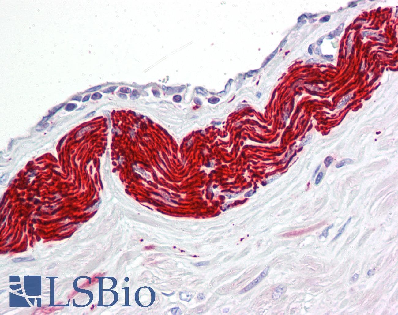 IHC-plus™ Polyclonal Rabbit anti-Human Peripherin Antibody (aa421-470, IHC, WB)