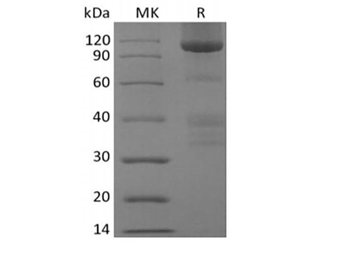 Human GPC3 / Glypican 3 Protein (Recombinant Fc, C-terminus)