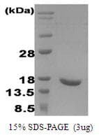 Human IFNA2 / Interferon Alpha 2 Protein (Recombinant)