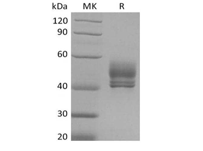 Cynomolgus CD3E + CD3D Protein (Recombinant Fc/6His,C-terminus)