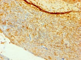 CD4 Antibody (aa26-396)