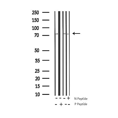 MAPT / Tau Antibody (phospho-Thr231)
