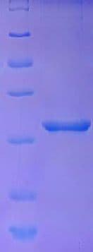 Human ESRG Protein (Recombinant His)