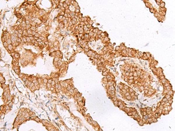 FAM200A Antibody