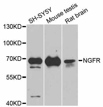 Polyclonal Rabbit anti-Human NGFR / CD271 / TNR16 Antibody (WB)