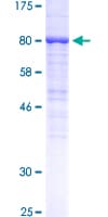Human EGFR Protein (Recombinant GST, N-terminus)