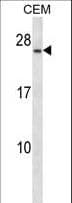 Polyclonal Rabbit anti-Human CD79A / CD79 Alpha Antibody (aa122-149, WB)