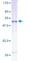 Human RAD51 / RECA Protein (Recombinant GST)