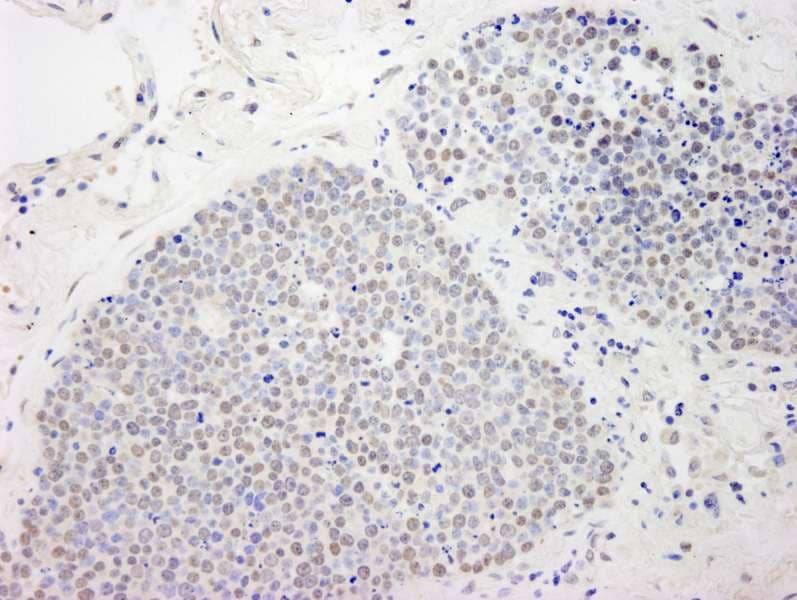 ATF7IP / MCAF1 Antibody (aa25-100)