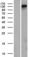 DGKeta / DGKH Protein (Over-Expression Lysate Myc-DDK (Flag))
